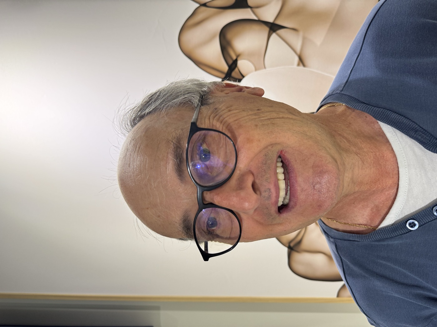 Same patient's teeth after treatment at Domus Dent