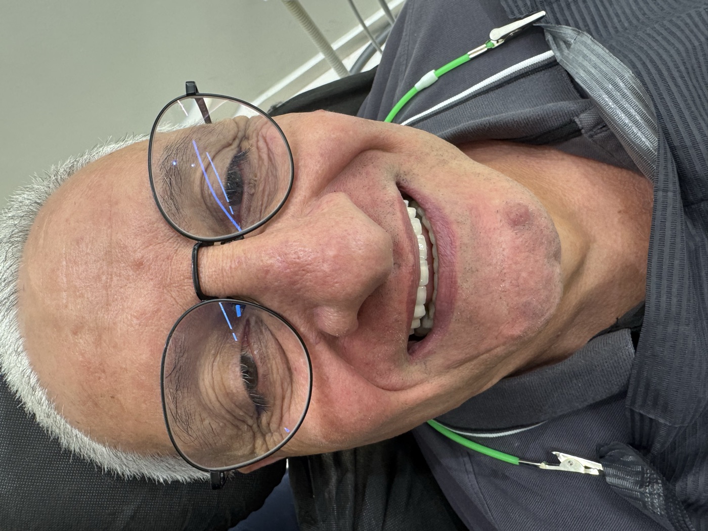 Same patient's teeth after treatment at Domus Dent
